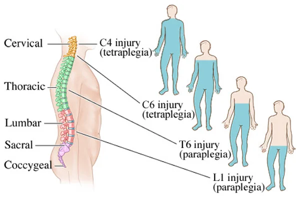 Traumatic Conditions of Spine