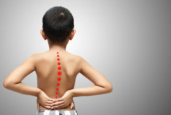 Pediatric Congenital Spine Deformities
