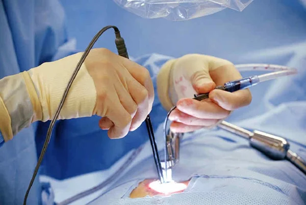 Spine Endoscopy